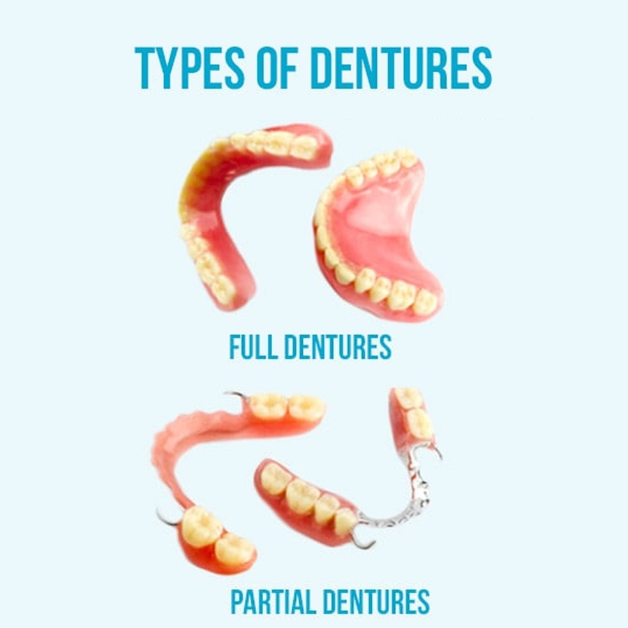 Types of denture